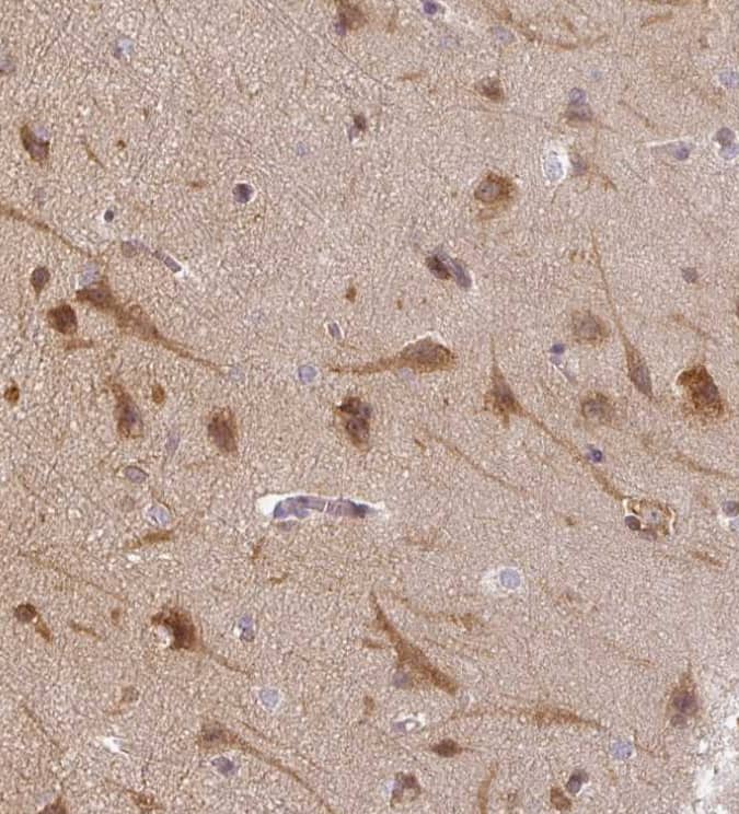Agpat4 Antibody - BSA Free