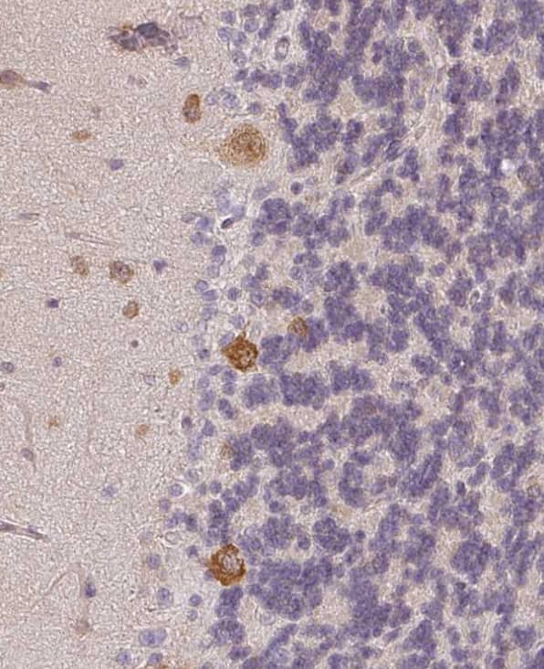 Agpat4 Antibody - BSA Free
