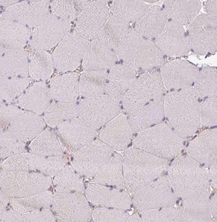 Agpat4 Antibody - BSA Free