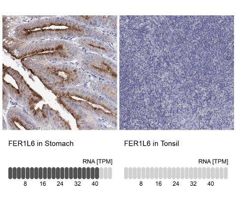 Fer-1-like protein 6 Antibody Fer-1-like protein 6 Antibody