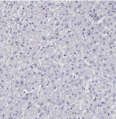 Fer-1-like protein 6 Antibody Fer-1-like protein 6 Antibody