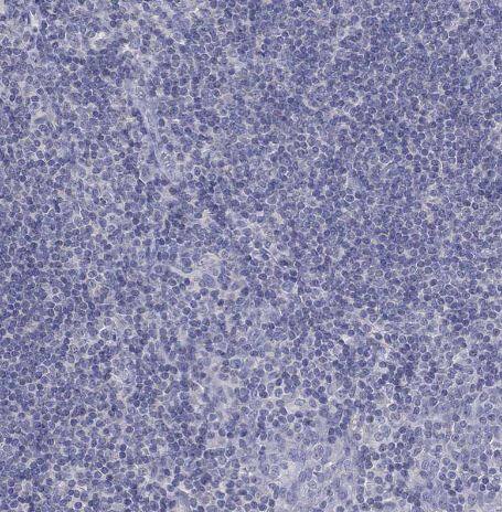 Fer-1-like protein 6 Antibody Fer-1-like protein 6 Antibody