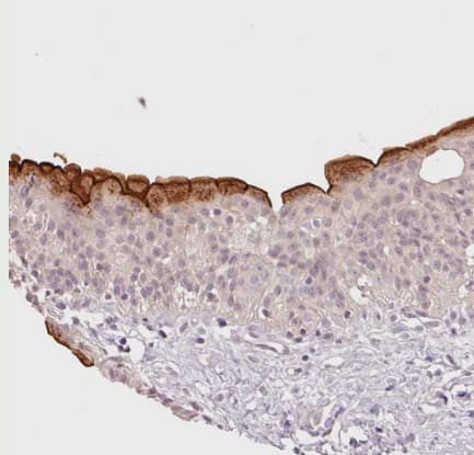 SLC29A3 Antibody - BSA Free