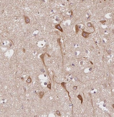 SLC29A3 Antibody - BSA Free