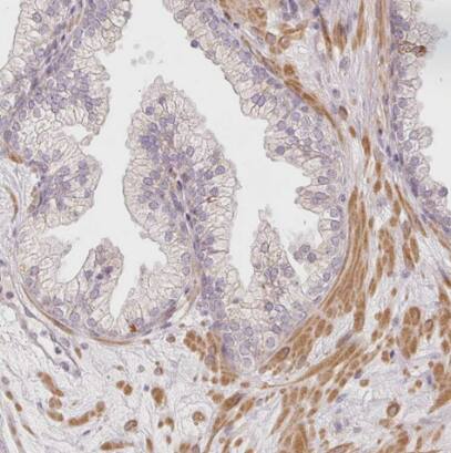 SLC29A3 Antibody - BSA Free