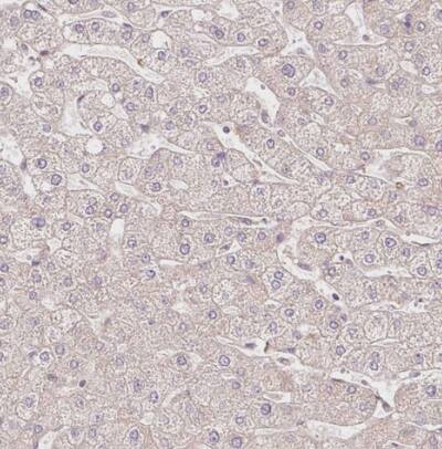 SLC29A3 Antibody - BSA Free