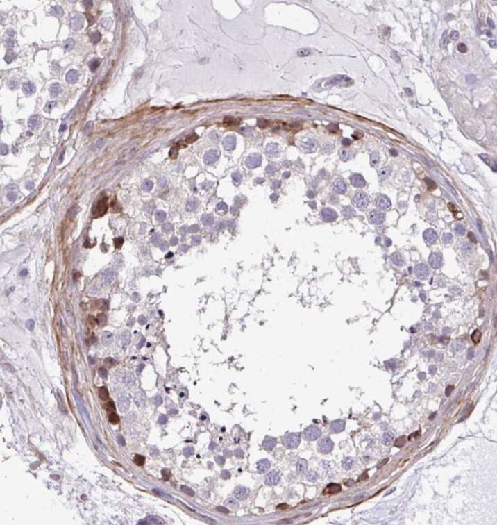 FIBCD1 Antibody - BSA Free