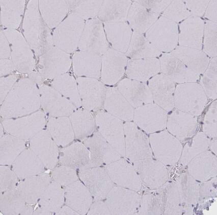 CEMP1 Antibody