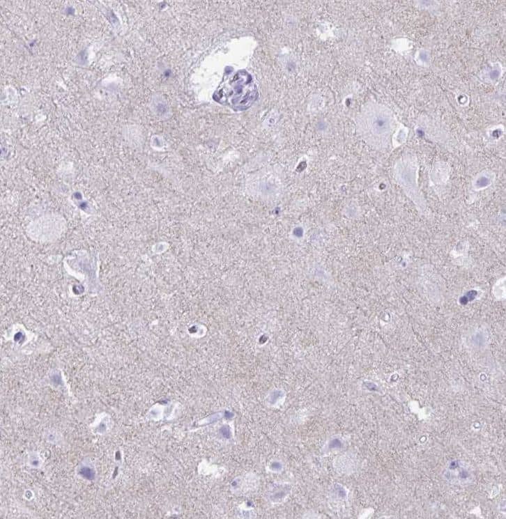 RHBDL3 Antibody