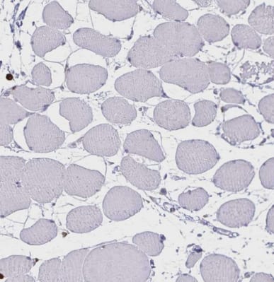ULBP-3 Antibody - BSA Free