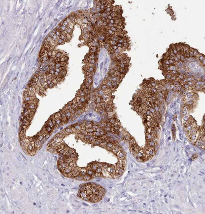 SRD5A1 Antibody - BSA Free