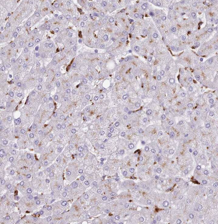 SRD5A1 Antibody - BSA Free