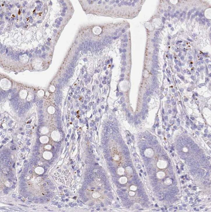 SRD5A1 Antibody - BSA Free