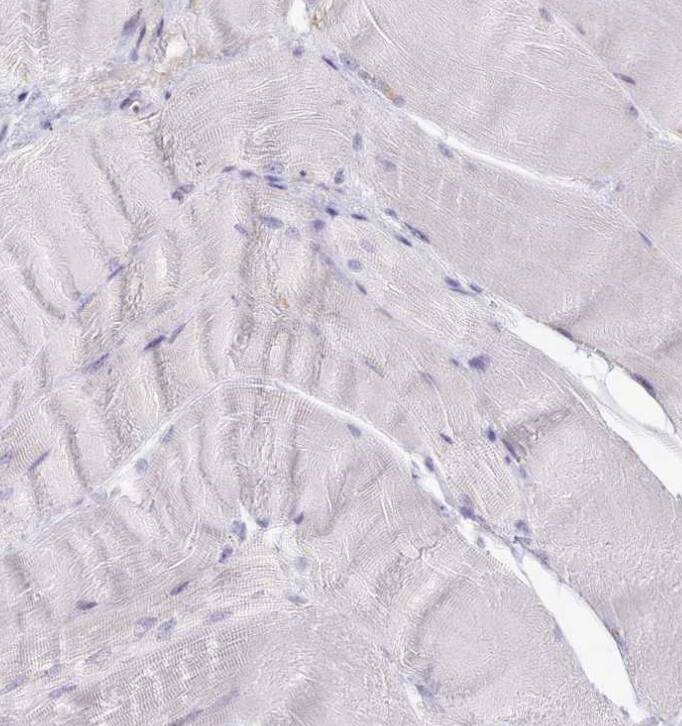SRD5A1 Antibody - BSA Free