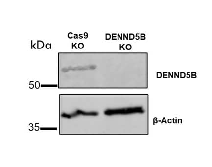 DENND5B Antibody - BSA Free