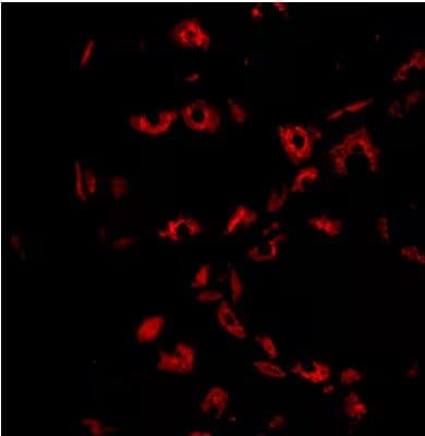 Hydrogen Potassium ATPase Beta Antibody Hydrogen Potassium ATPase Beta Antibody