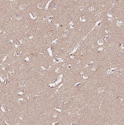 PGLYRP2/PGRP-L Antibody