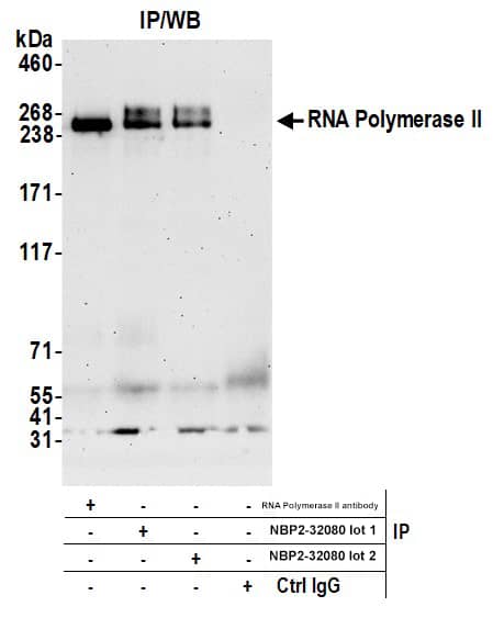 RNA Polymerase II/POLR2A Antibody