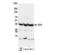 ADK Antibody
