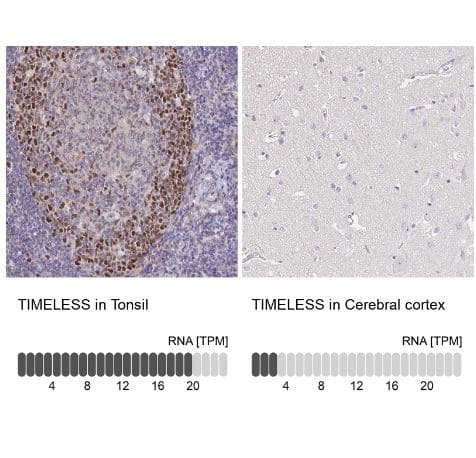 Timeless Antibody