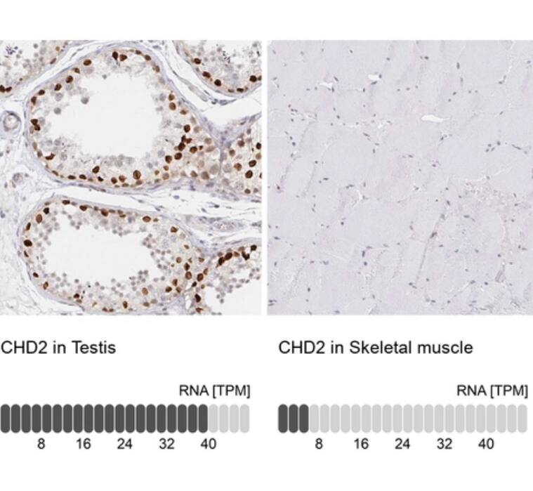CHD2 Antibody - BSA Free