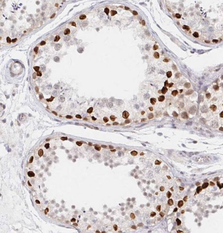 CHD2 Antibody - BSA Free
