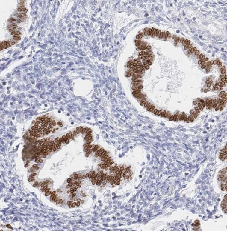 CHD2 Antibody - BSA Free