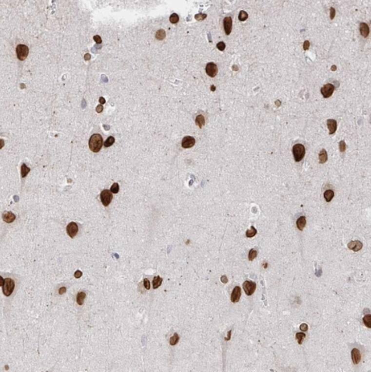 CHD2 Antibody - BSA Free