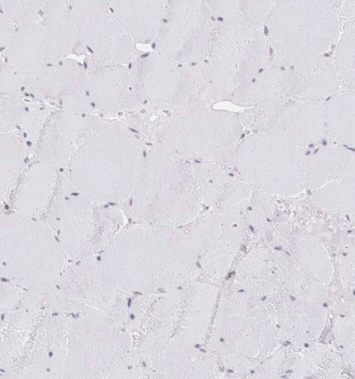 CHD2 Antibody - BSA Free