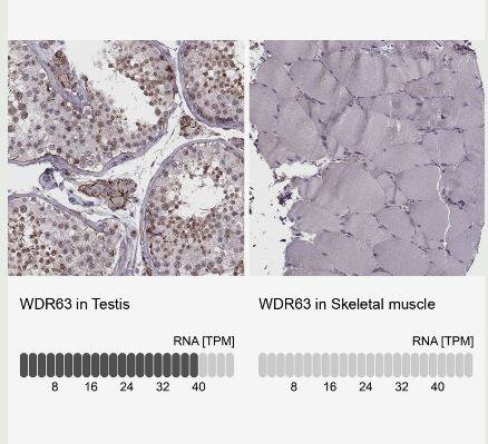 WDR63 Antibody