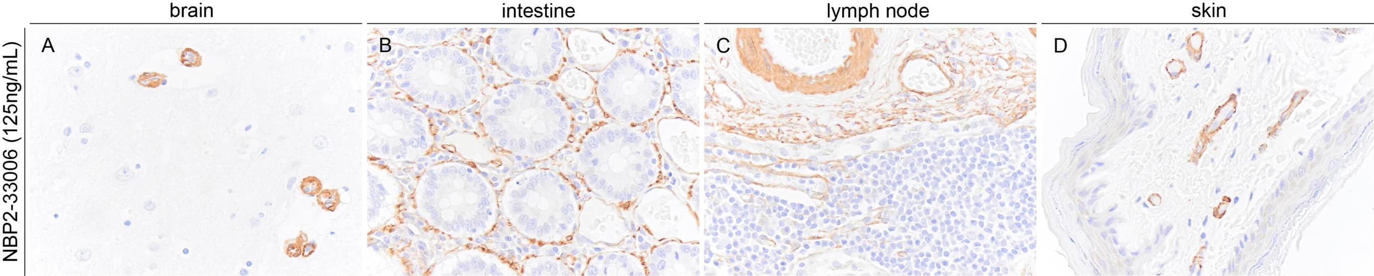 alpha-Smooth Muscle Actin Antibody (1A4/asm-1) - BSA Free