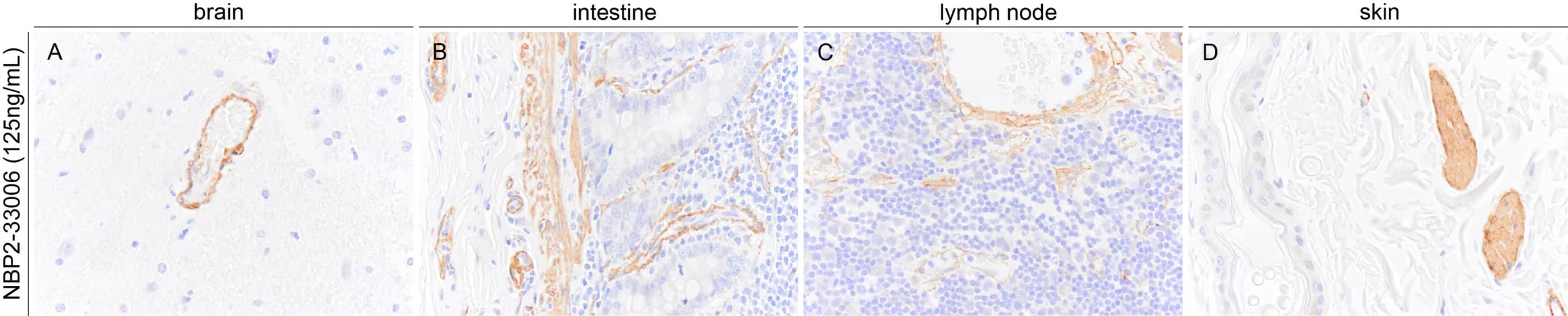 alpha-Smooth Muscle Actin Antibody (1A4/asm-1) - BSA Free