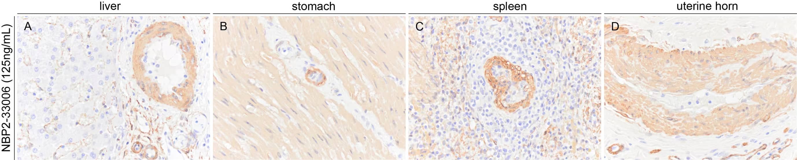 alpha-Smooth Muscle Actin Antibody (1A4/asm-1) - BSA Free
