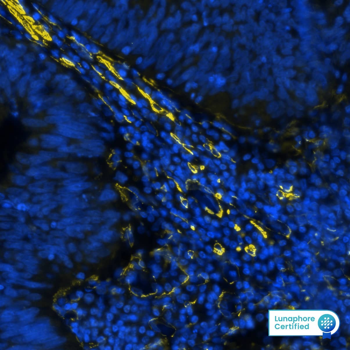 alpha-Smooth Muscle Actin Antibody (1A4/asm-1) - BSA Free