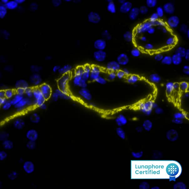 alpha-Smooth Muscle Actin Antibody (1A4/asm-1) - BSA Free Detection of SMA in Mouse Lung via seqIF™ staining on COMET™