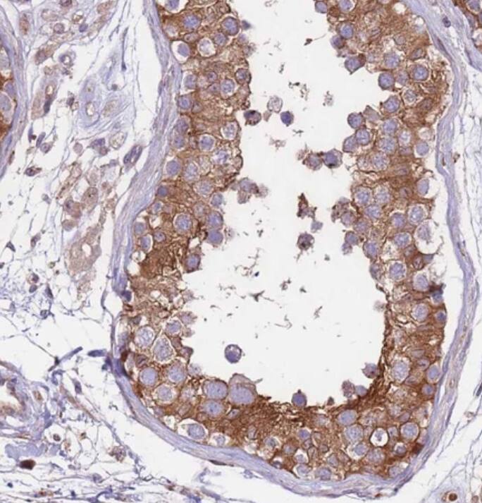 DDX19B Antibody - BSA Free