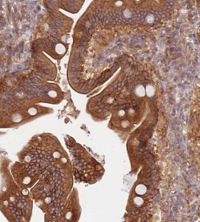 DDX19B Antibody - BSA Free