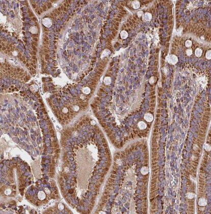 SLMO2 Antibody