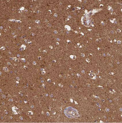 SLMO2 Antibody