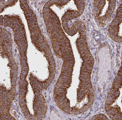 SLMO2 Antibody