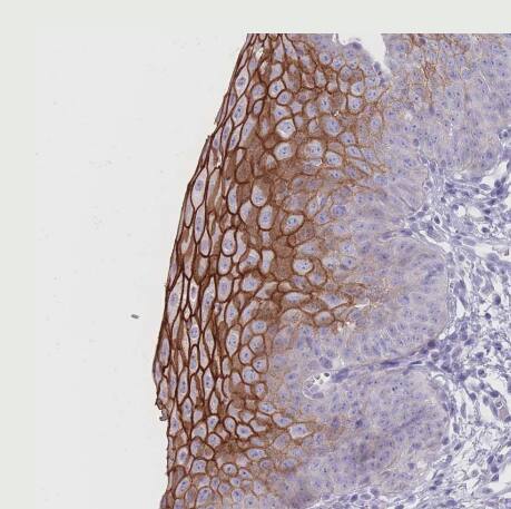 RHBG Antibody