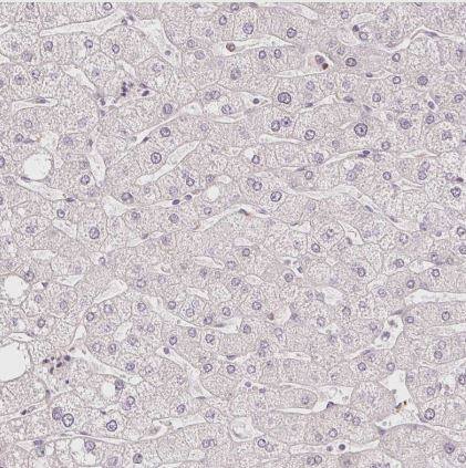 ABHD11 Antibody