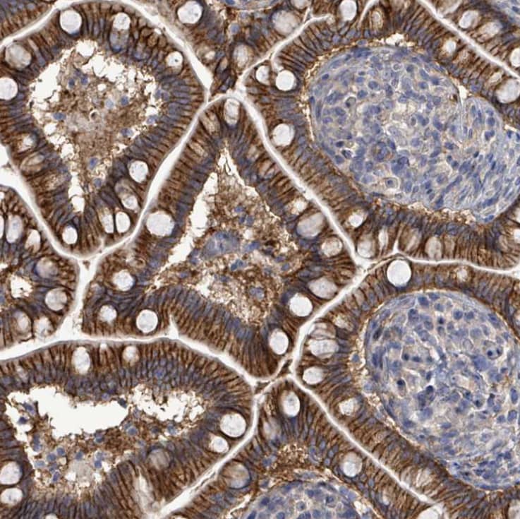 KRAS Antibody - BSA Free