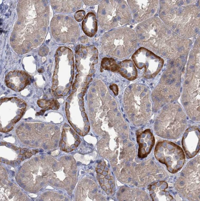 KRAS Antibody - BSA Free