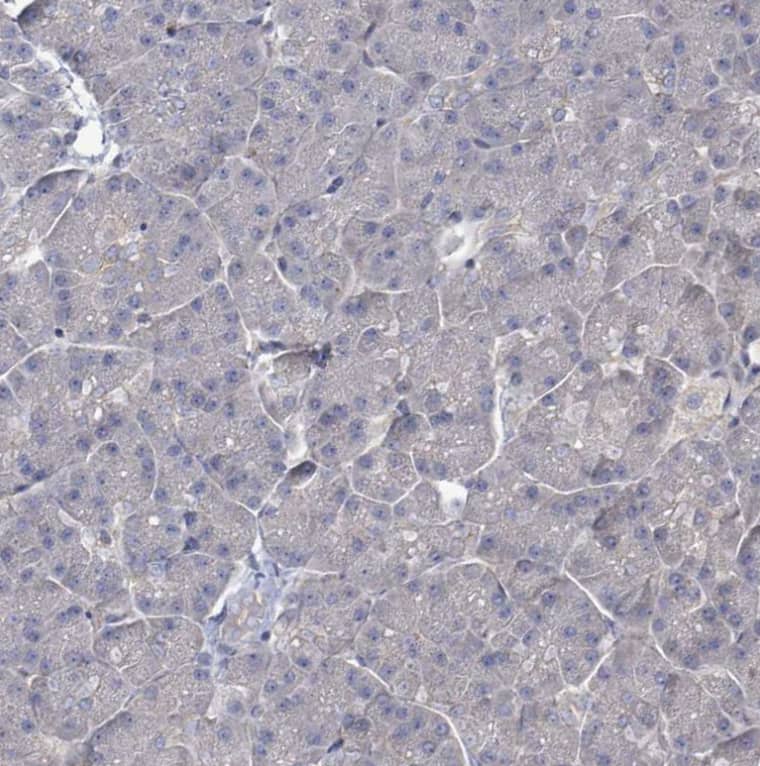 KRAS Antibody - BSA Free