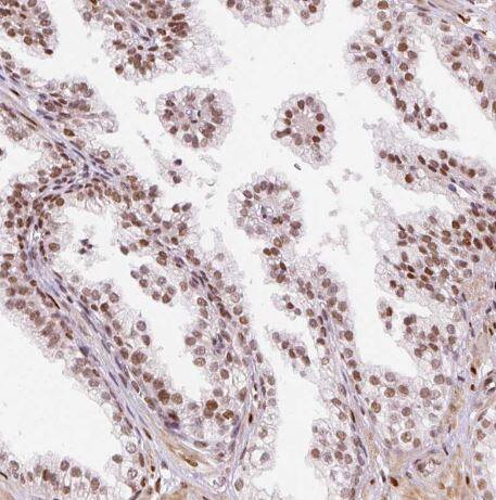 hnRNP C1 + C2 Antibody