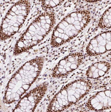 hnRNP C1 + C2 Antibody