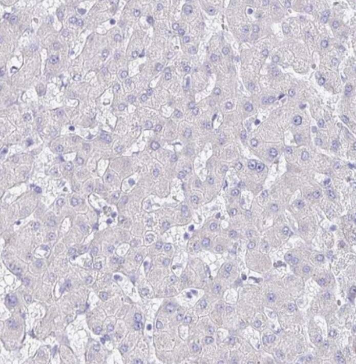 SLC44A4 Antibody - BSA Free