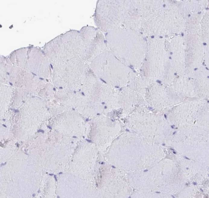 TAS2R38 Antibody - BSA Free