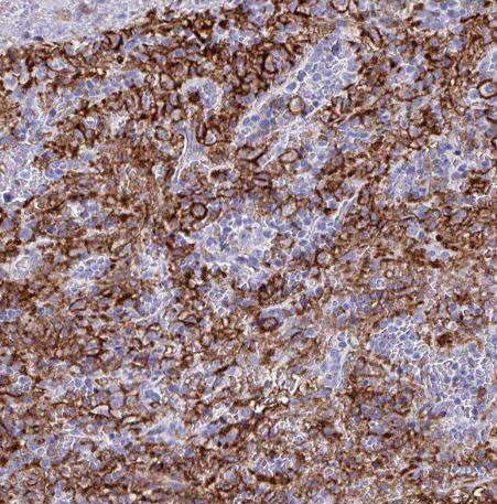 Fc gamma RIIIA/CD16a Antibody